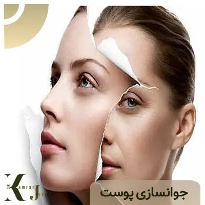 جوانسازی پوست
