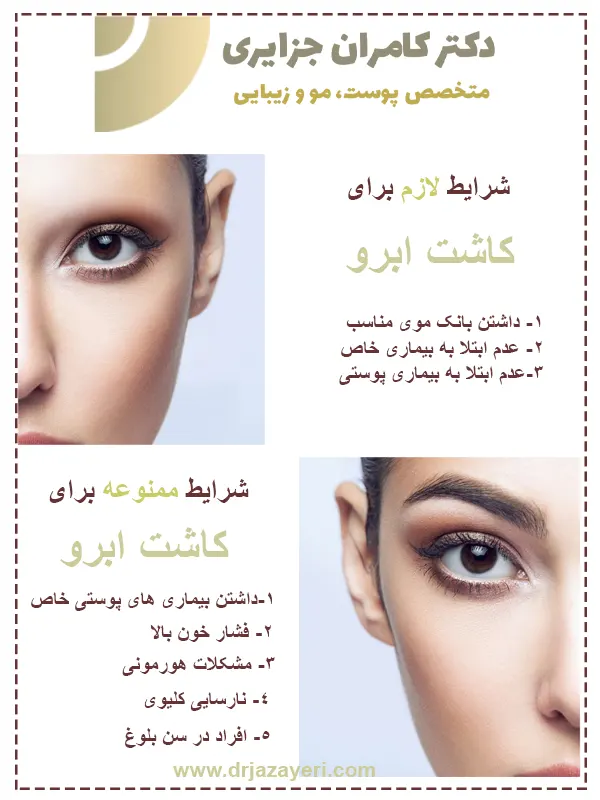 شرایط کاشت ابرو