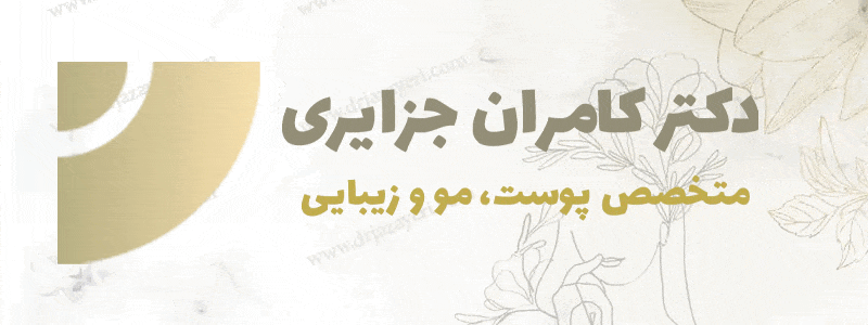 نمونه کارهای کاشت ابرو دکتر جزایری