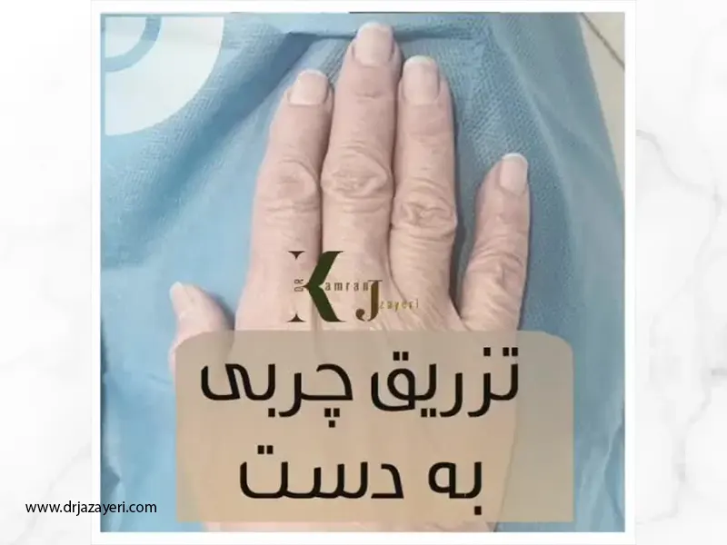 جوانسازی دست