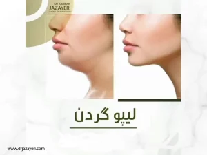 لیپوماتیک گردن