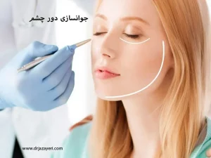 جوانسازی دور چشم