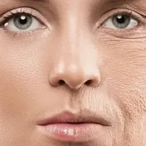 جوانسازی صورت توسط بهترین متخصص پوست و مو