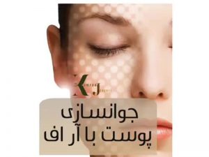 جوانسازی پوست با آر اف