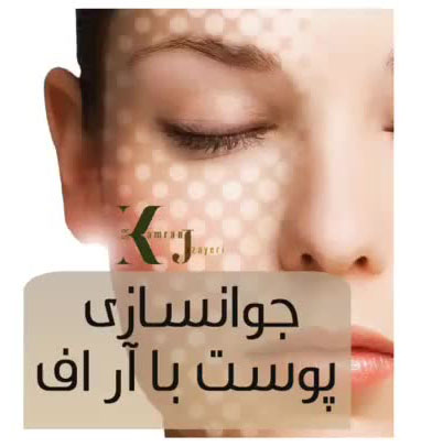 جوانسازی پوست با لیزر آر اف فرکشنال