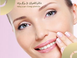 ازبین-بردن-خط-لبخند