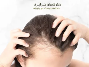 میکروپیگمنتیشن
