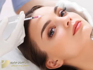 کاربرد بوتاکس