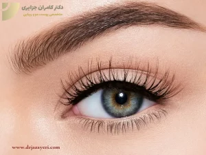 از بین بردن تتو