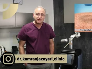 لیزر co فرکشنال