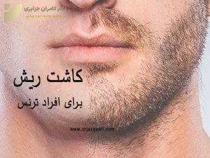 کاشت ریش در افراد ترنس