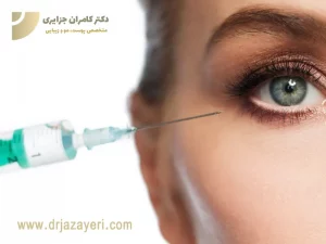 کربوکسی تراپی