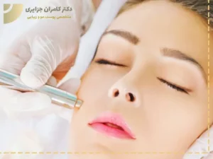 میکرودرم ابریژن