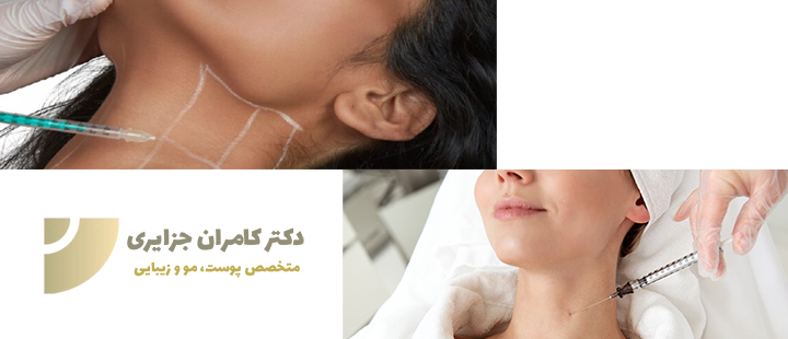 دراباره تزریق بوتاکس به گردن