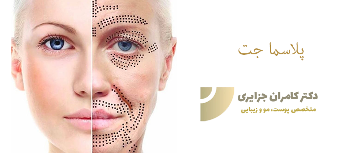آشنایی با پلاسما جت