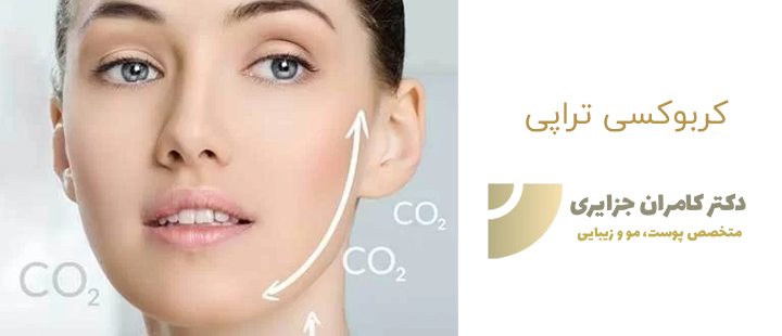 آشنایی با کربوکسی تراپی
