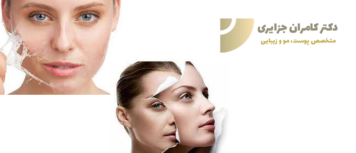 بهترین روش های جوانسازی صورت
