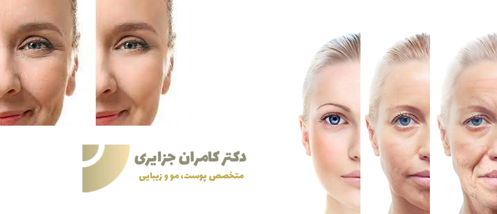 تزریق چربی به صورت چیست؟