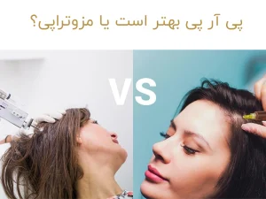 پی آر پی بهتر است یا مزوتراپی؟