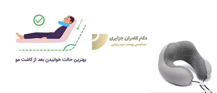 بهترین حالت خوابیدن پس از کاشت مو