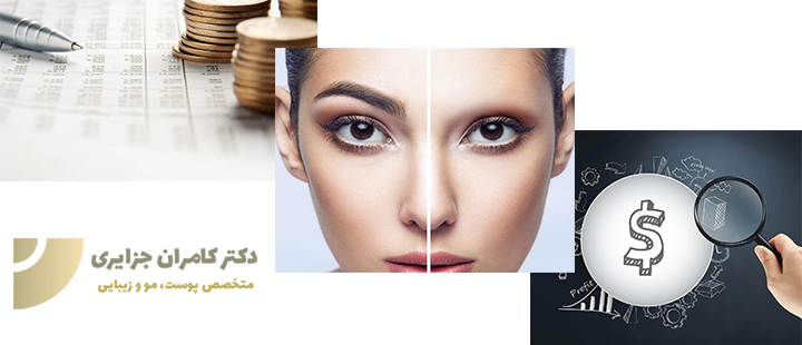 درباره هزینه کاشت ابرو