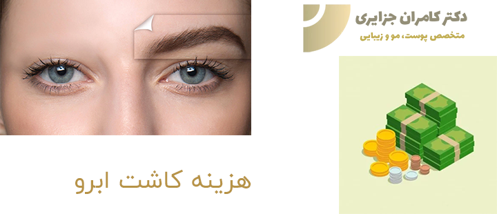 هزینه کاشت ابرو چه قدر است؟
