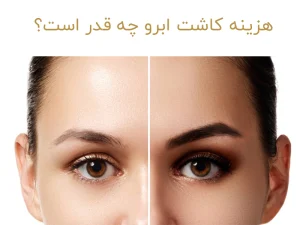 هزینه کاشت ابرو چه قدر است؟