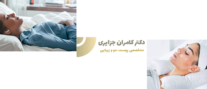 بهترین شکل خوابیدن بعد از کاشت ابرو