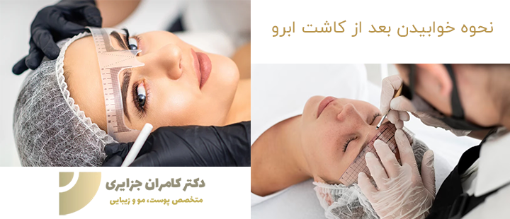 درباره نحوه خوابیدن بعد از کاشت ابرو