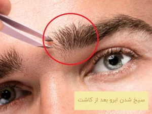 سیخ شدن ابرو بعد از کاشت