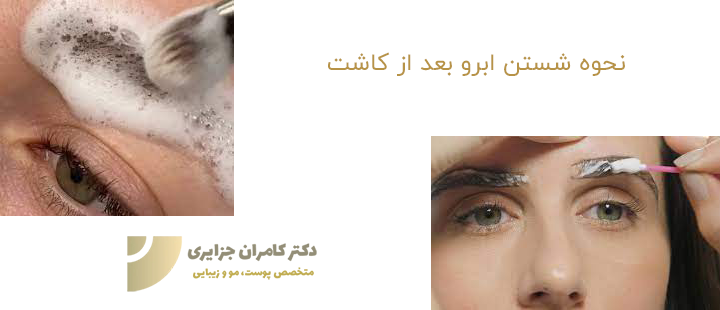 نحوه شستن ابرو بعد از کاشت