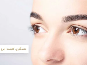 ماندگاری کاشت ابرو