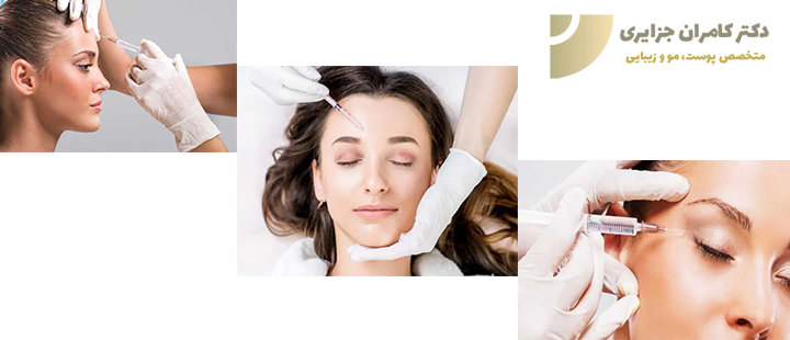 مدت ماندگاری تزریق بوتاکس