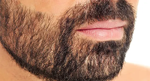 کاشت ریش و سبیل