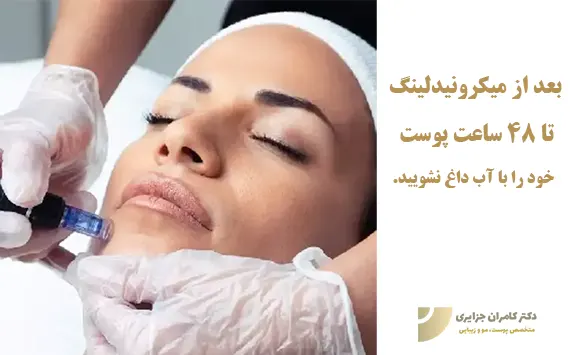 شستشوی صورت بعد میکرونیدلینگ