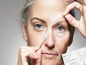 نکات مراقبتی بعد از پروفایلو